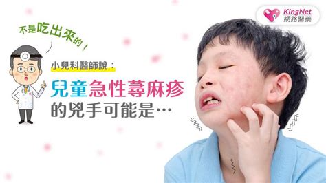 小兒半夜蕁麻疹|不是吃出來的！兒童感染科醫師：小孩子的「蕁麻疹」。